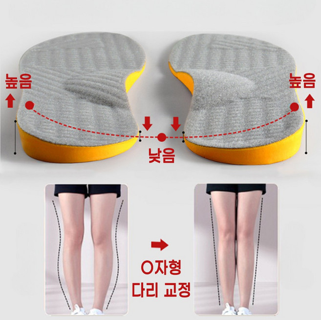 [5시건 당일출고] 1+1+1 오다리 교정 보조 깔창 2026 업그레이드 발균형 자세보정 인솔, 3세트