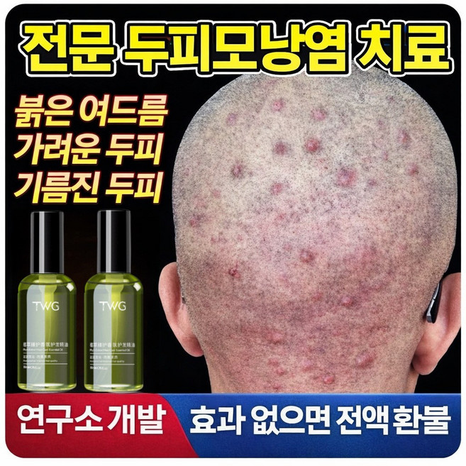 두피 모낭염 샴푸 머리 두피 가려움 여드름 뾰루지 트러블 지루성두피 모낭염 두피열 시카 진정토닉, 4개, 50ml