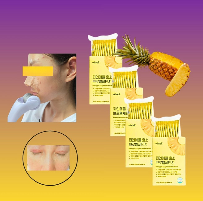 붓기빼 브로멜라민 눈 코 성형후 얼굴 붓기 효소 2달치 역가수치, 2박스, 60회분