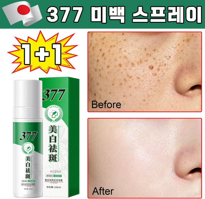 377 미백 스프레이 기미 잡티 제거 수분 영양 얼굴 색소침착 제거 잡티 완화 검버섯 피부개선 얼굴미스트, 2개, 100ml