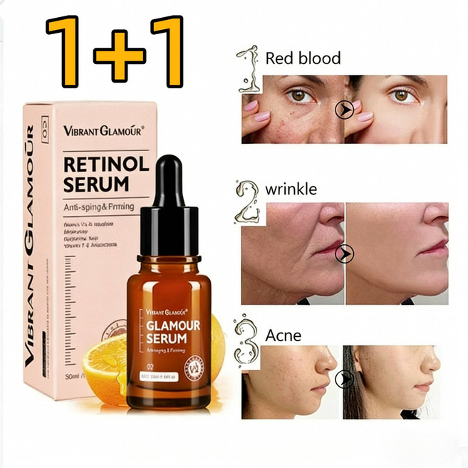 [팔자주름 제거 크림1위] 얼굴 주름 없애는 크림 얼굴 주름 없애는 크림 팔자주름 제거 크림1위 EGF주름 레티놀세럼, 2개, 30g