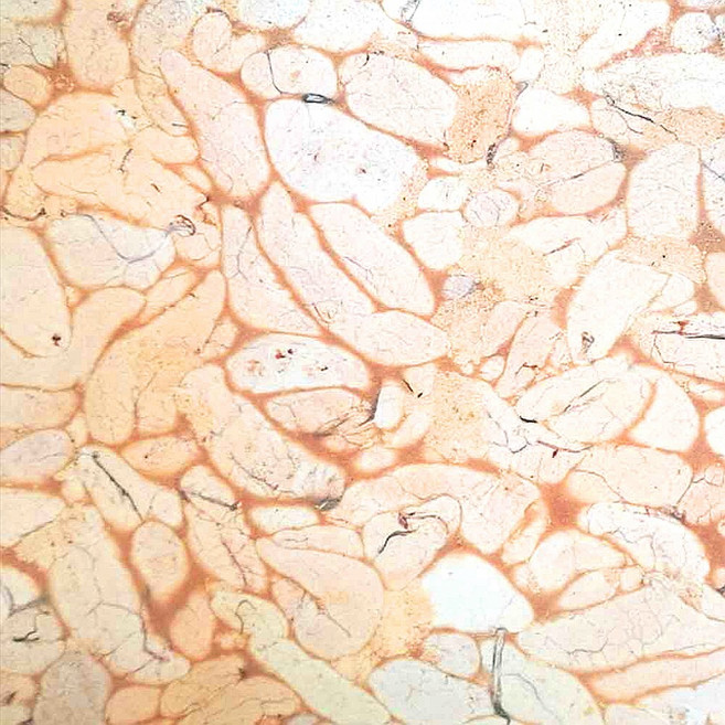 (배터짐) 업소용 냉동 러시아산 동태알 명태알 7.5kg 2팩 도매 (일요일&당일발송), 2개
