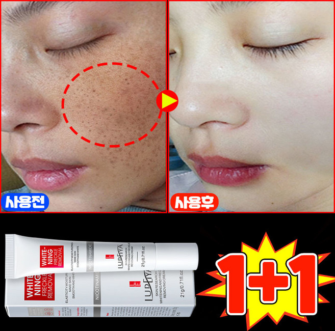 [100% 효과있음] 멜라논 크림 기미크림 기미 잡티 주근깨 검버섯 제거 크림 착색 미백 크림 들깨기미크림 색소침착 화이트닝 LUPEIYA 포장증정, 2개, 21g