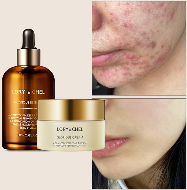 로리앤첼 글로리어스 수분 보습 크림 & 에센스 세트, 크림+에센스, 1세트