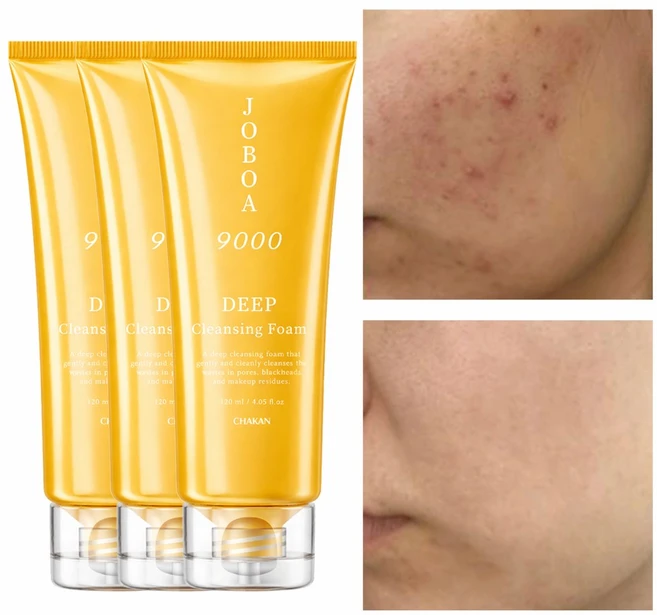여드름 모공 각질 노폐물 제거 호호바 9000 딥 클렌징폼, 120ml, 3개 - 쿠팡