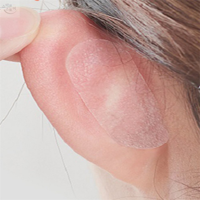 엘프 귀 스티커 성형, 홈없음