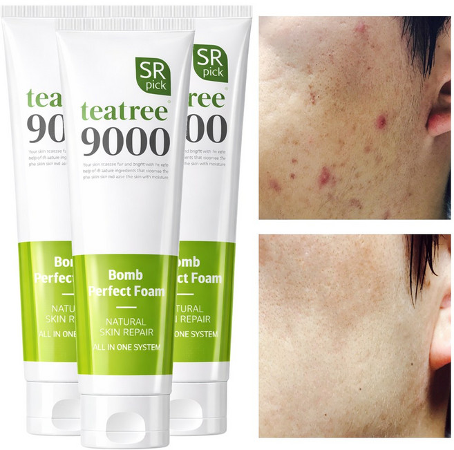 트러블 자국 각질 모공수축 티트리폭탄 폼클렌징 120ml, 3개