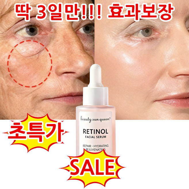 [미백앰플 1위] 피부과추천 얼굴 에센스 레티놀원액100% 레티놀 앰플 여성 에센스 주름 개선 에센스 앰플 에센스 레티놀 세럼 모공 앰플 미백 앰플, 1개, 30g