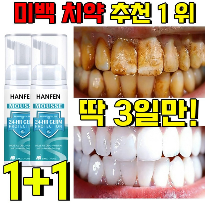 1+1 누렁니 미백 치약 추천 1 위 화이트닝 치약 하이드록시아파타이트 치약 잇몸 치약 누렁니 미백 치약 화이트닝 치약 저불소 천연 구취 입냄새 제거 치아 미백, 2개, 50ml