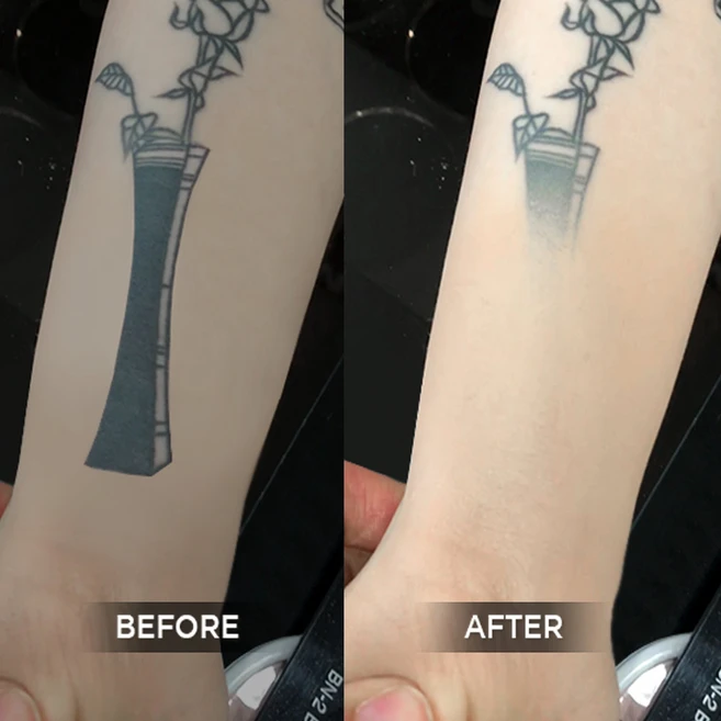 벤나이 타투커버 솔루션 (옵션선택필수), 07_벤나이 파이널실 매트 2 oz, 1개 - 쿠팡