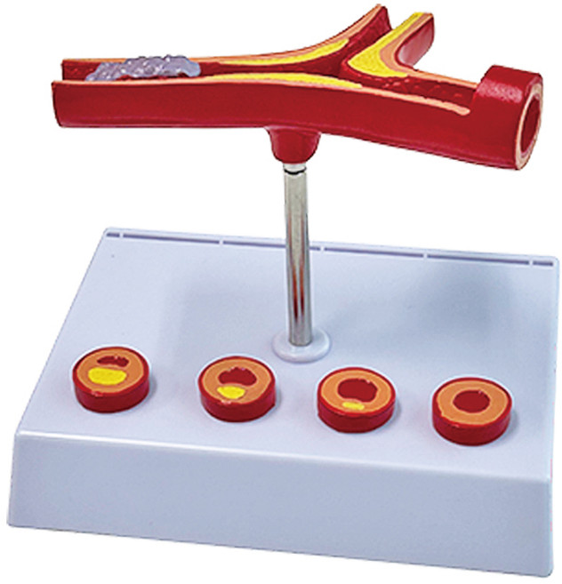 카르빈 동맥 혈관 해부 모형