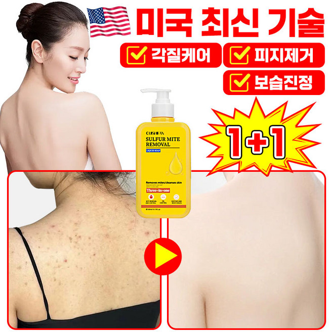 [효과보장]1/1+1 유황 바디워시100% 유황 바디워시 데일리 딥클렌징 샤워 물비누 향균 여드름 등드름 가려움증 개선 완화 피지감소 각질제거 고농축 목욕 입욕제 LUPEIYA, 2개, 300ml