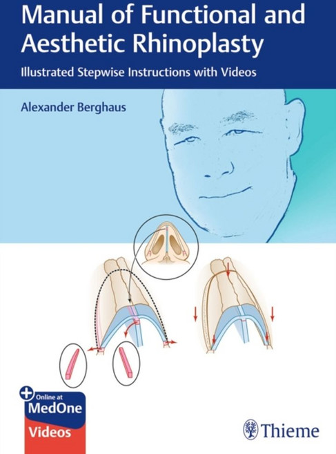 Manual of Functional and Aesthetic Rhinoplasty:Illustrated Stepwise Instructions with Videos, Manual of Functional and Aes.., Berghaus, Alexander(저), Thieme