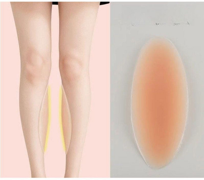 O자 다리 종아리 실리콘 패드 보정 일자다리 스티커 오다리 스킨 싱글, 투명 1 켤레