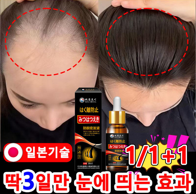 1/1+1 탈모 앰플 탈모 예방 영양제 탈모증상완화 두피 영양제 헤어 에센스, 1개, 30ml