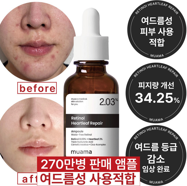 여드름성 피부 사용 적합 트러블 진정 개선 모공감소 피지연화 잡티감소 5종 임상완료 [270만병 판매기념 할인] 고함량 레티놀 어성초 히알루론산 나이아신아마이드 뮤아마 앰플, 1개, 30ml