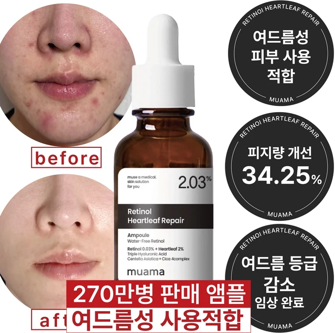 여드름성 피부 사용 적합 사춘기 트러블 진정 개선 흉터 모공감소 피지연화 5종 임상완료 [누적 270만병] 고함량 나이아신아마이드 레티놀 어성초 히알루론산 뮤아마 앰플 세럼, 1개, 30ml - 쿠팡