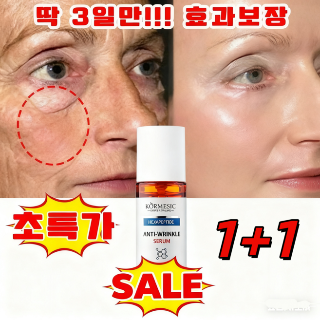 주름개선 크림 팔자주름 제거 크림1위 팔자필러크림 여성 수분크림1위 얼굴 주름 없애는 크림 주름 미백 탄력크림 90초회춘팔자주름크림 여성 영양크림 추천 60대, 30g, 2개