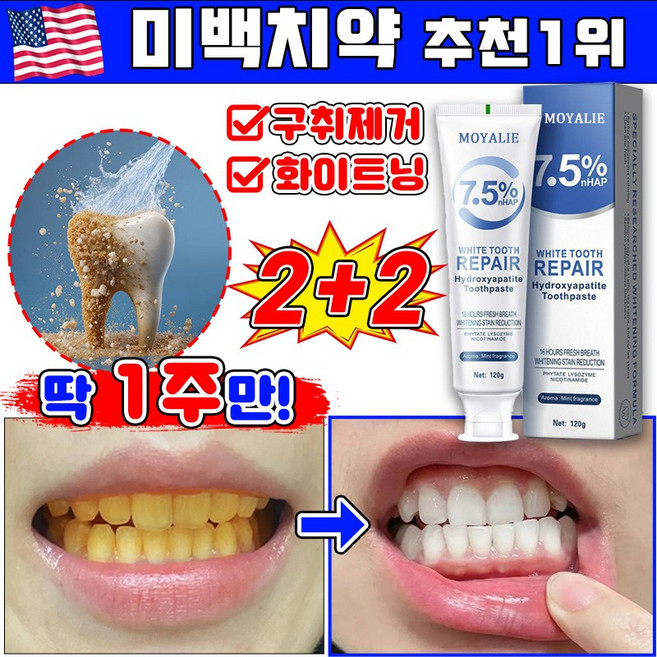 미백 치약 추천1위 미백치약 치약미백 누렁니 미백 치약 화이트닝 치약 치아 미백치약 입냄새제거 구취제거 치아미백 누렁니제거 치석제거 LUPEIYA, 4개, 120g
