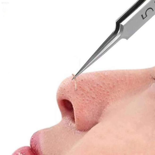 초미세 핀포인트 피지 핀셋 여드름 각질 블랙헤드 제거 압출 족집게 얼굴 피부 관리 용품 [와치댓], 1개