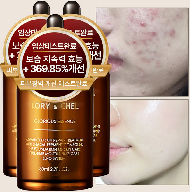 로리앤첼 글로리어스 에센스 앰플 세럼 80g, 3개