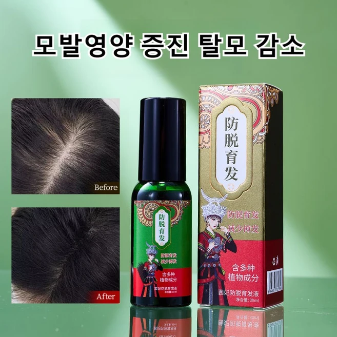 천연 식물 탈모방지 에센스 헤어 영양제 탈모 치료 모발 성장 촉진 모발 생력 증진 모발영양 모발 강인화 두피 진정, 탈모 방지제30ml, 3개 - 쿠팡