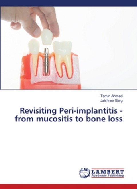 (영문도서)Revisiting Peri-implantitis - from mucositis to bone loss Paperback, LAP Lambert Academic Publis..., English, 9786207805563