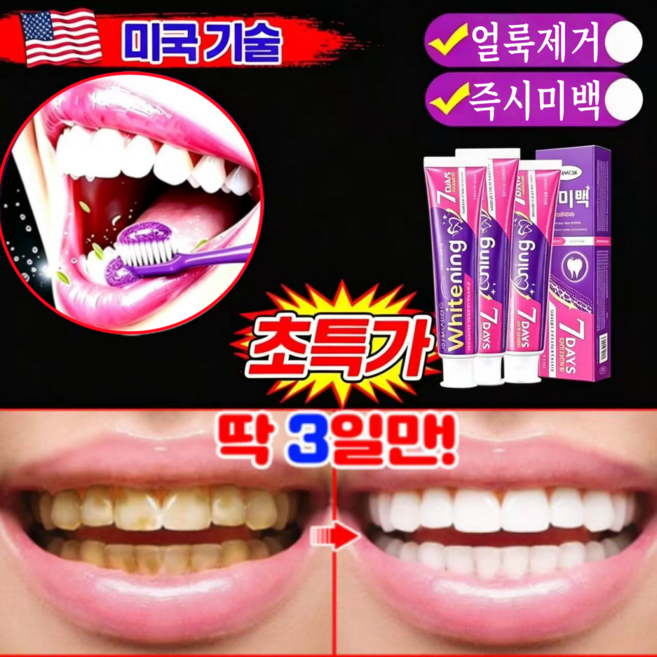 {당일배송}[치과추천1위]보라색 고함량 미백치약 치아황반 개선 입냄새 케어 프로바이오틱스 함유 담배 커피 착색 제거 구강케어, 2개, 100ml