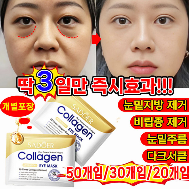 [국내배송] 50개/30개20개/ 눈밑지방 제거 아이 패치 아이백 다크서클 눈밑꺼짐 눈밑주름 제거 팔자 주름개선 패치 아이케어 포장 증정, 1개, 10개입