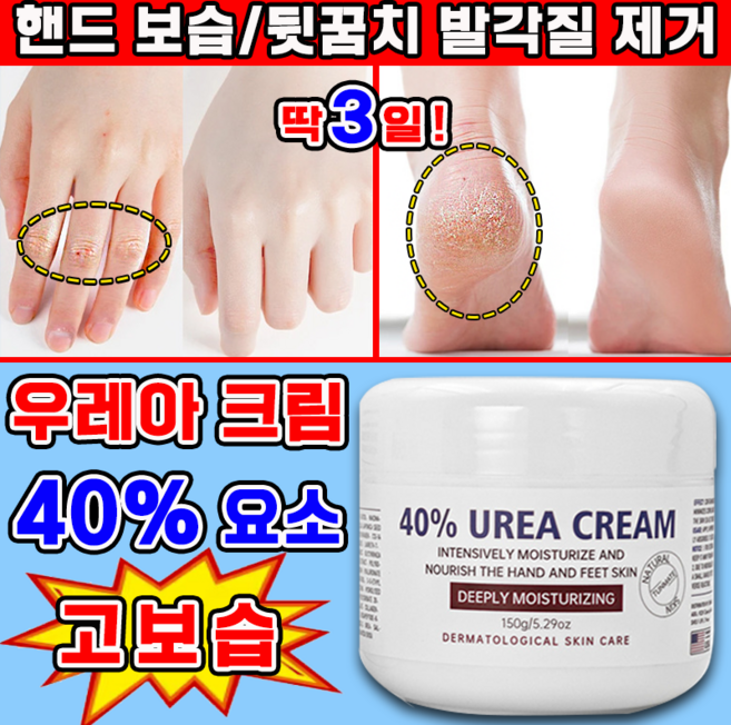 유리아 크림 우레아 풋크림 함익병 유레아 크림 뒷꿈치 피부연화제 유리아크림 발 각질제거 고보습 풋크림 사은품 증정, 149g, 1개, 1개입