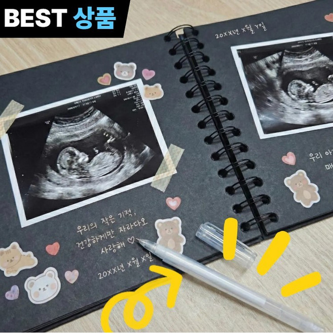 로엘느 초음파 앨범 태교 다이어리 꾸미기, 1세트, 20매, 모던블랙