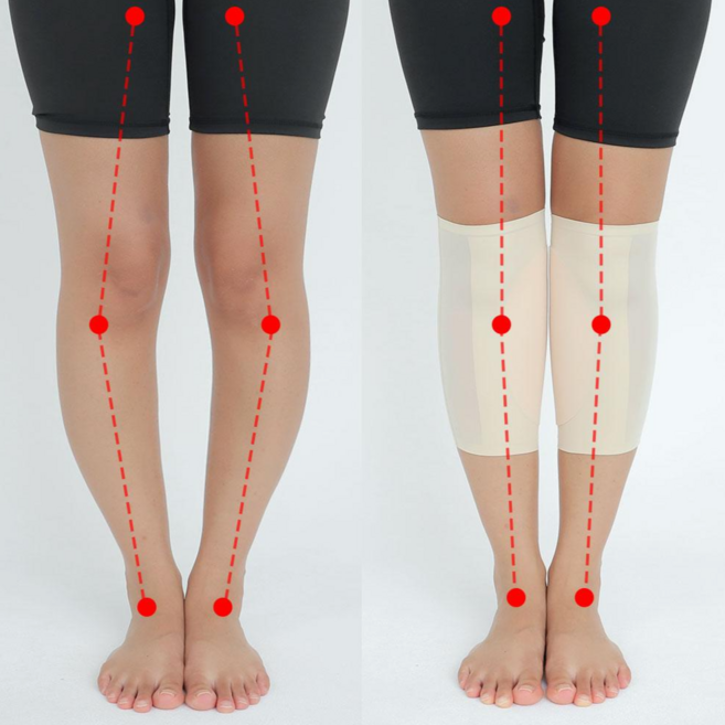 오다리뽕 바디픽션 오다리교정 교정기 보정밴드, 1세트