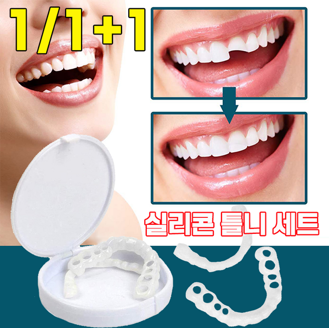 실리콘 세트 임시 교정기 상하 이빨 셀프 만들기 치과 재료 보장증정, 1개입