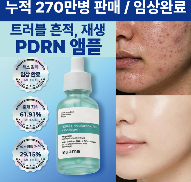 1위 흔적 앰플 피부결 광채 임상완료 [누적 270만병 판매] 수분 속보습 물광피부 재생 PDRN 앰플 뮤아마 PDRN 히알루론산 콜라겐 앰플, 1개, 30ml