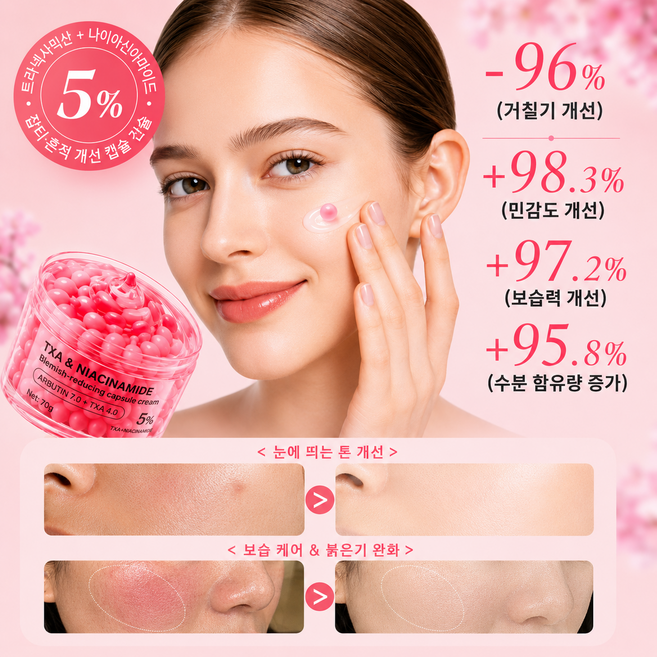 대용량[신상 출시|성분UP]쥐젖 비립종 제거 크림 연고 크림 멜라논 크림 기미 잡티 제거 크림1위 캡슐크림 검버섯 제거 크림1위 착색 미백 크림 톤업크림, 1개, 70g