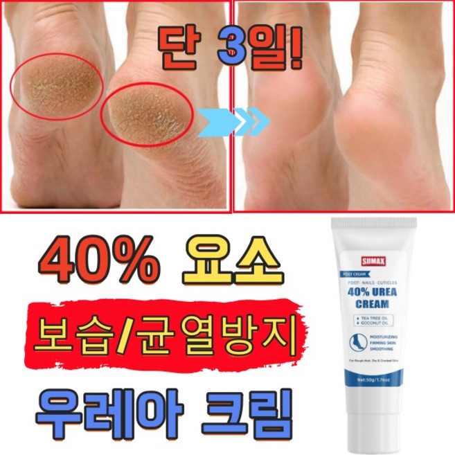크림 풋크림 우레아 풋크림 발 관리 거칠고 벗겨지는 발 문제 해결, 1개