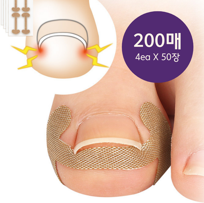 메디인랩 내성발톱테이프 발톱 케어 보호 밴드 200매, 1세트