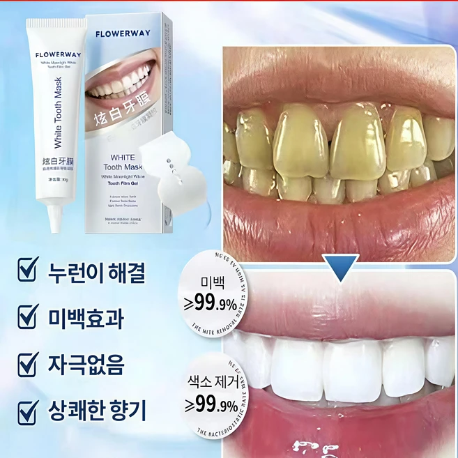 [당일 발송]치석치약/엔치약/치탄플러스/치아미백/즉시 미백/ 구취 제거/ 3D치아 착색 전용 미백 겔/ QQ13, 1개, 30g - 쿠팡