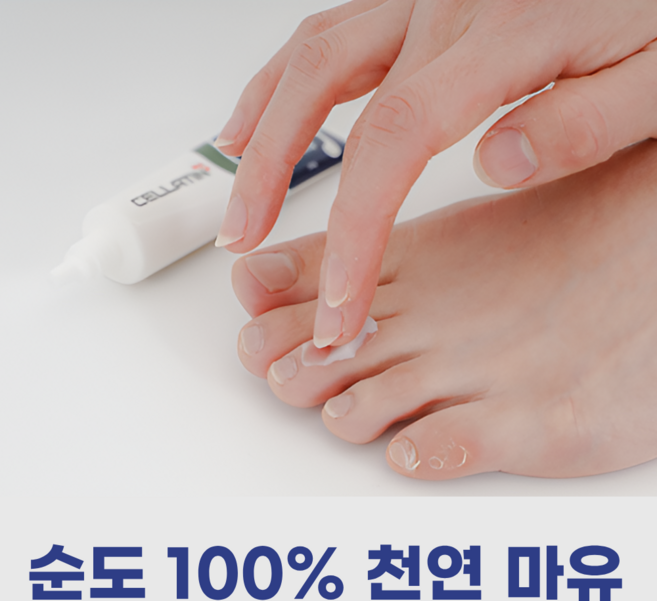 제이블릭 내성 발톱 연화제 발무좀 습진 연고 크림 임산부 각질 제거 발냄새 살균 티트리 무좀연고 습진크림 각질연고 각질크림 내성발톱연고 내성발톱크림 무좀크림 습진연고, 문제성 무좀습진 발크림20g, 1개, 1개입