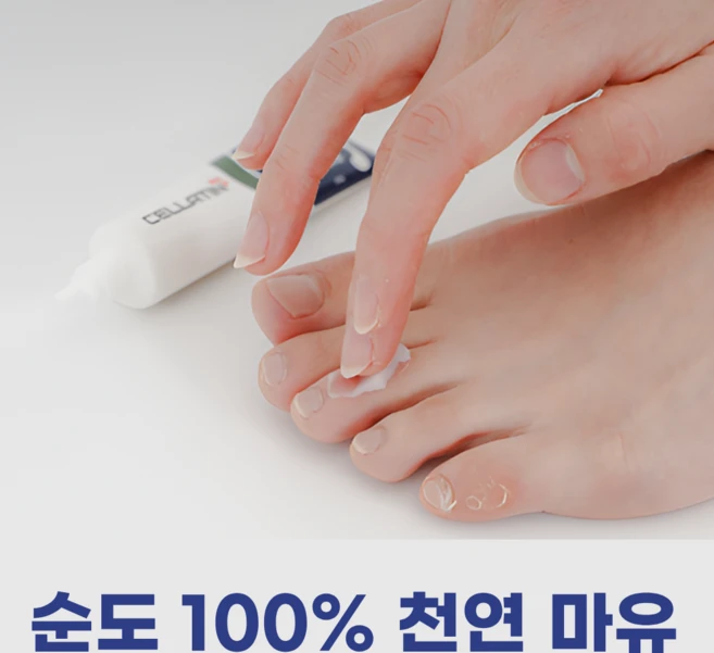 제이블릭 내성 발톱 연화제 발무좀 습진 연고 크림 임산부 각질 제거 발냄새 살균 티트리 무좀연고 습진크림 각질연고 각질크림 내성발톱연고 내성발톱크림 무좀크림 습진연고, 문제성 무좀습진 발크림20g, 1개, 1개입 - 쿠팡