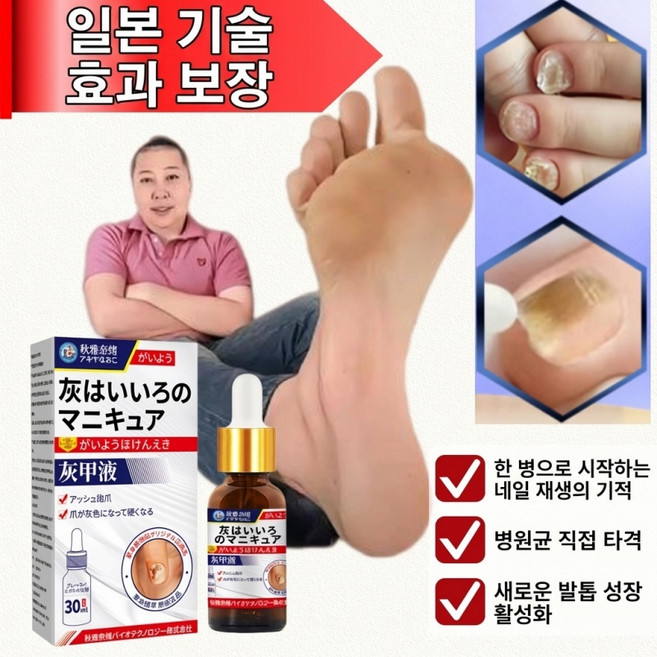 [국내배송] 발톱 앰플 솔루션 문제성발톱 앰플 발톱 곰팡이 한번에 끝내는 손발톱 영양제, 5개, 30ml