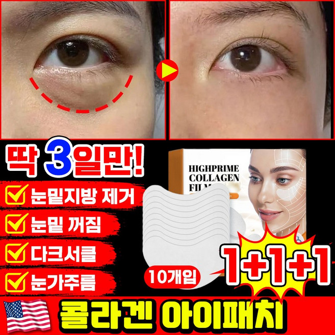 [당일출고 | 국내배송] 1/1+1/2+2 콜라겐 아이패치 눈밑 지방제거 패치 눈가주름 패치 다크서클 눈밑꺼짐 제거 아이팩 아이백 리프팅 아이케어 LUPEIYA, 3개, 10개입