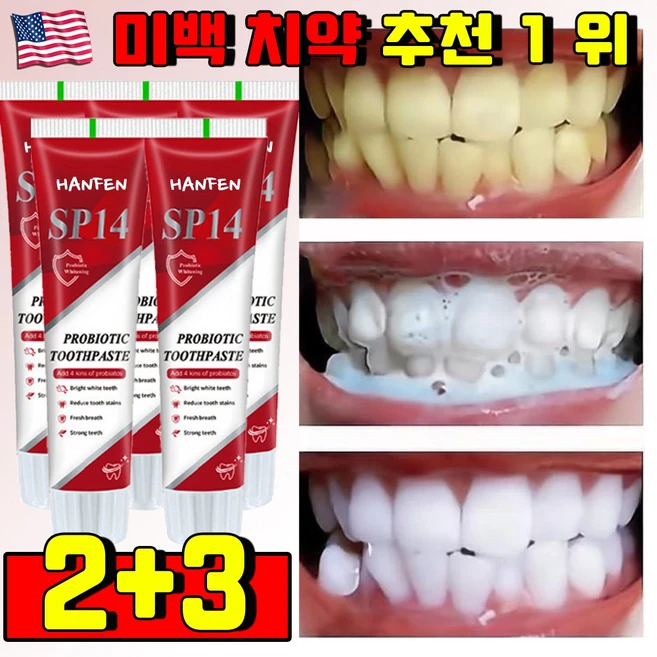 [미백보장] 미국 프리미엄 SP14 미백 치약 추천 1 위 화이트닝 치약 치아미백 치석제거 치약 누렁니 미백치약 잇몸 치약 무불소 치약, 5개 - 쿠팡