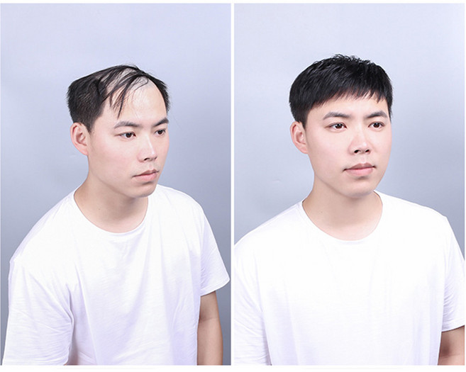 마녀플랜트 남자가발 남자부분가발 붙임러리 남성인모가발, 마오인치, 1개