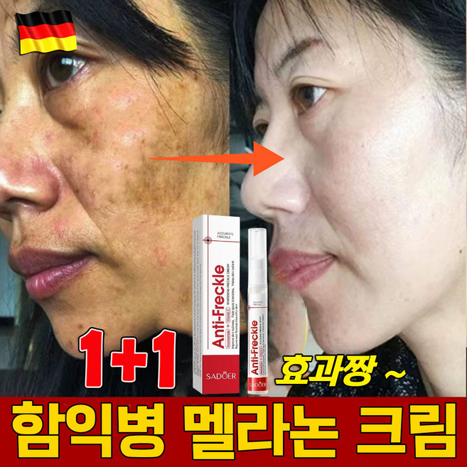 [효과짱] 멜라논 크림 기미 잡티 크림1위 얼굴 색소침착 착색크림 피부 재생 보습 탄력 미백 멜라토닝 미백 검버섯크림, 1개, 15g