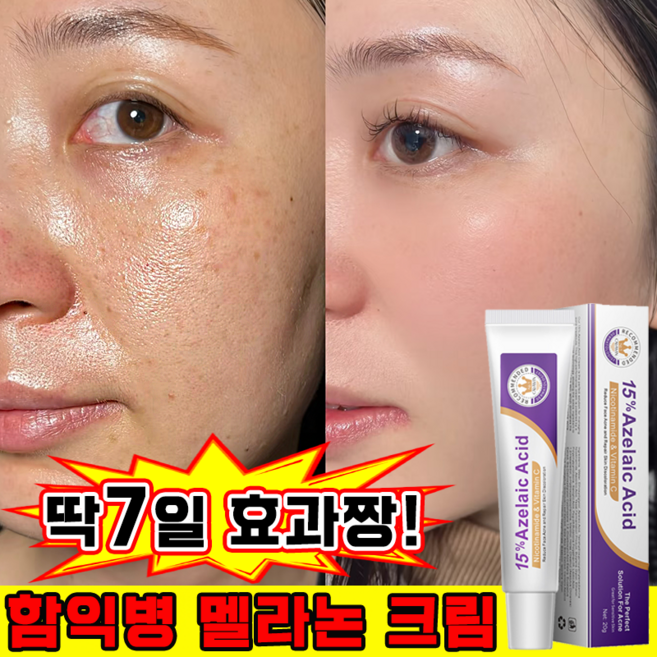 함익병 기미크림 멜라논 크림 함익병 기미 잡티 제거 크림1위 착색크림 얼굴 색소침착 화이트닝 피부 재생크림 보장증정, 4개, 20g