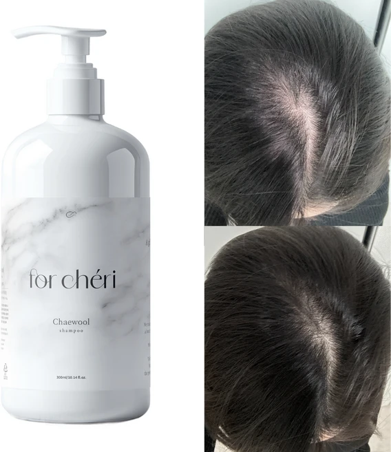 포셰리 탈모완화 안티에이징 저속노화샴푸 채울, 1개, 300ml - 쿠팡