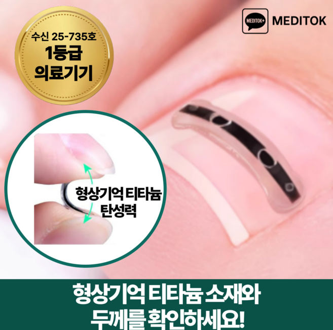 메디톡 티탄토우 내성발톱 교정기 교정밴드 티타늄 의료기기 테이프 파고드는 발톱 관리 교정팁, 10개