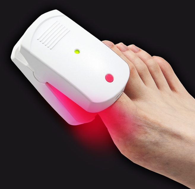 국내생산 특허보유 문제성 손발톱 레이저 관리기 원세의료기 네일레이저, 화이트