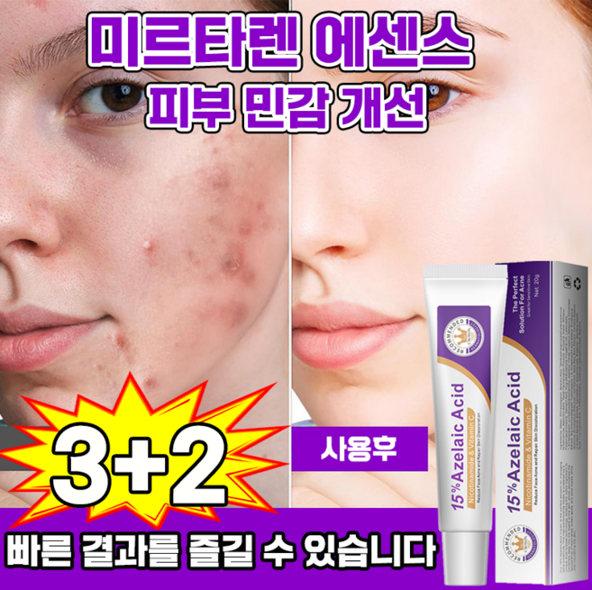 9위 - 함익병 멜라논 크림 동아제약 함익병 기미 잡티 제거 멜라논 크림 착색크림 함익병 동화제약, 5개, 20g